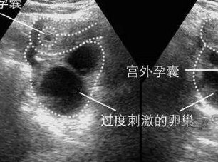 大同试管医院哪好？什么样的试管医院值得选择？