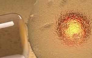 2026云南试管费用报销政策解读